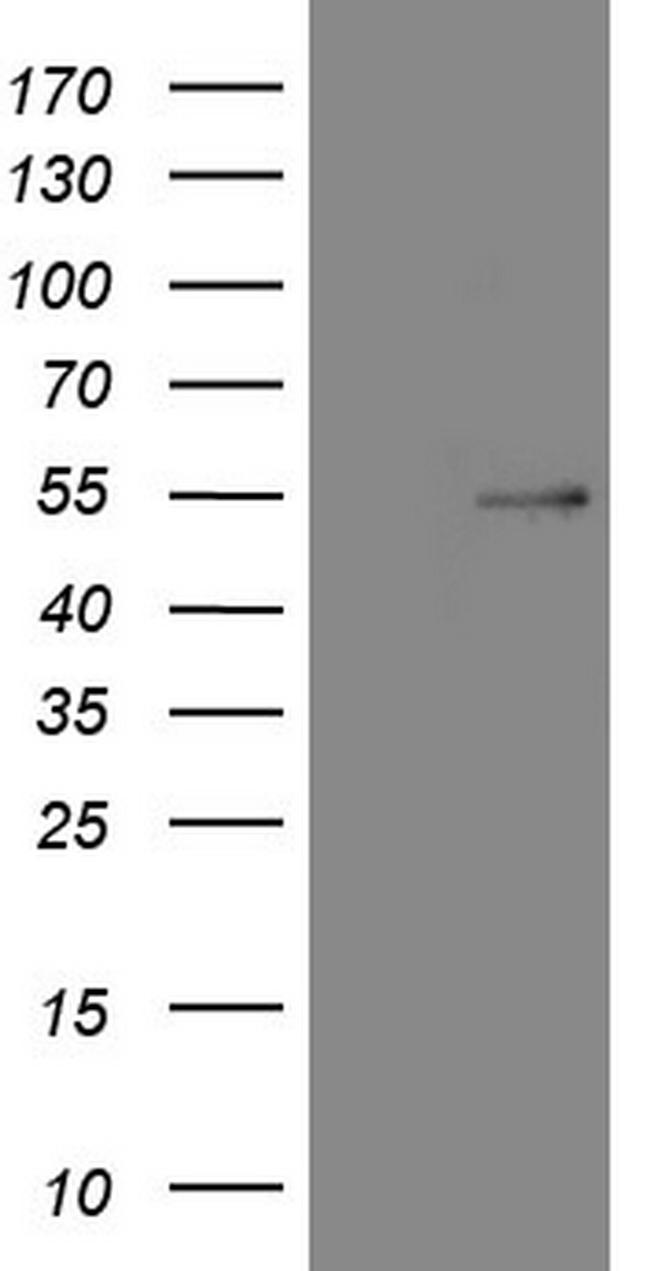 NR5A1 Antibody in Western Blot (WB)