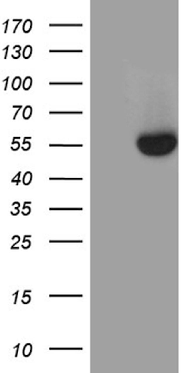 NR5A1 Antibody in Western Blot (WB)