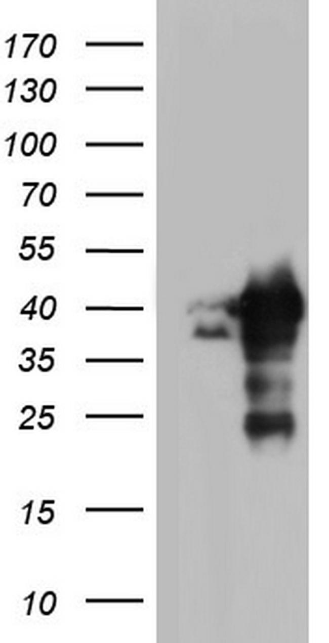 NRBF2 Antibody in Western Blot (WB)