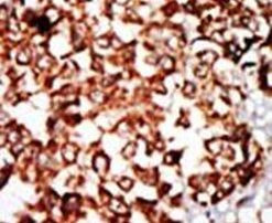 NRBP Antibody in Immunohistochemistry (IHC)