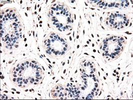 NRBP1 Antibody in Immunohistochemistry (Paraffin) (IHC (P))