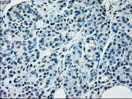 NRBP1 Antibody in Immunohistochemistry (Paraffin) (IHC (P))