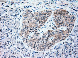 NRBP1 Antibody in Immunohistochemistry (Paraffin) (IHC (P))