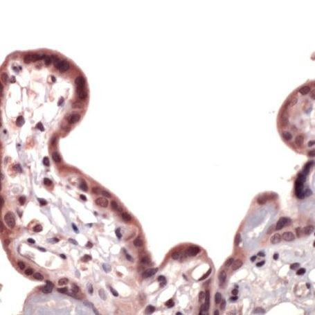 Nrf2 Antibody in Immunohistochemistry (IHC)