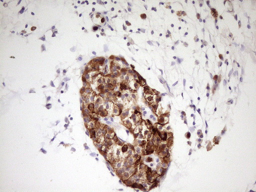 NTRK1 Antibody in Immunohistochemistry (Paraffin) (IHC (P))