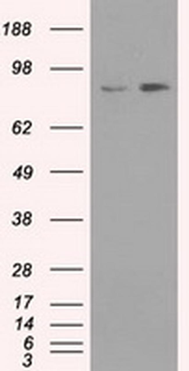 NTRK3 Antibody in Western Blot (WB)