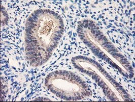 NUBPL Antibody in Immunohistochemistry (Paraffin) (IHC (P))
