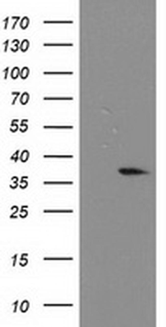 NUBPL Antibody in Western Blot (WB)