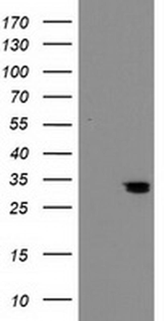 NUBPL Antibody in Western Blot (WB)
