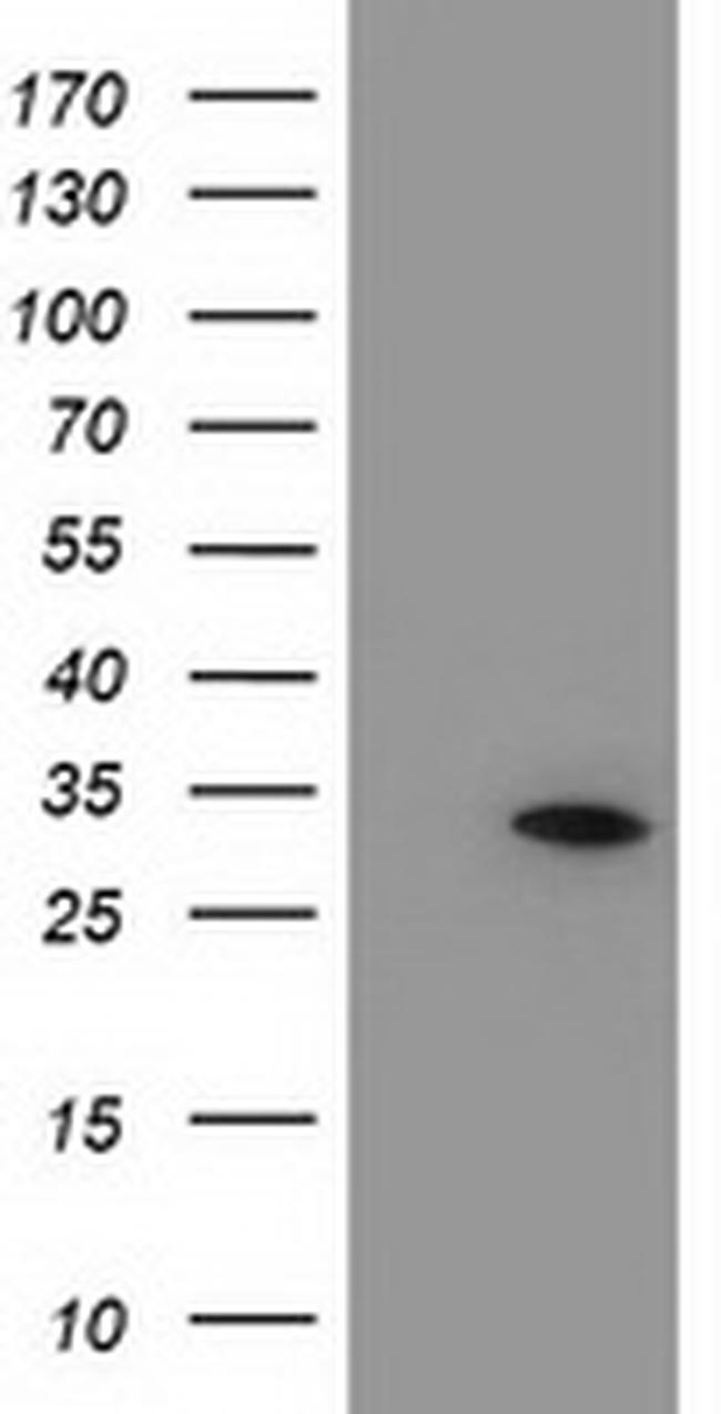 NUBPL Antibody in Western Blot (WB)