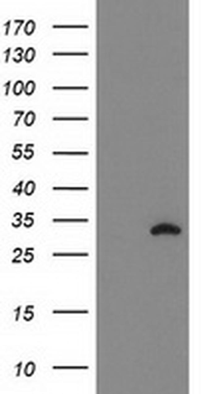 NUBPL Antibody in Western Blot (WB)