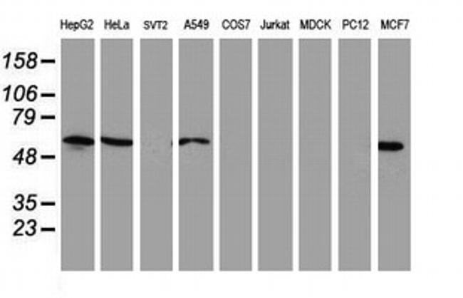 NUCB1 Antibody in Western Blot (WB)