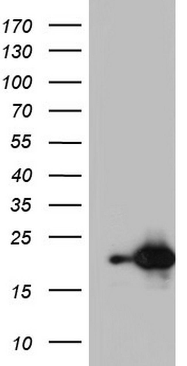 NUDT10 Antibody in Western Blot (WB)