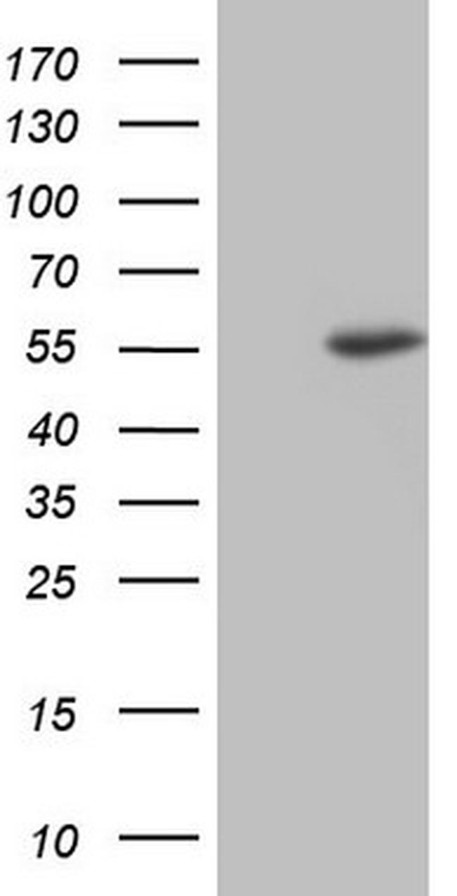 NUDT12 Antibody in Western Blot (WB)