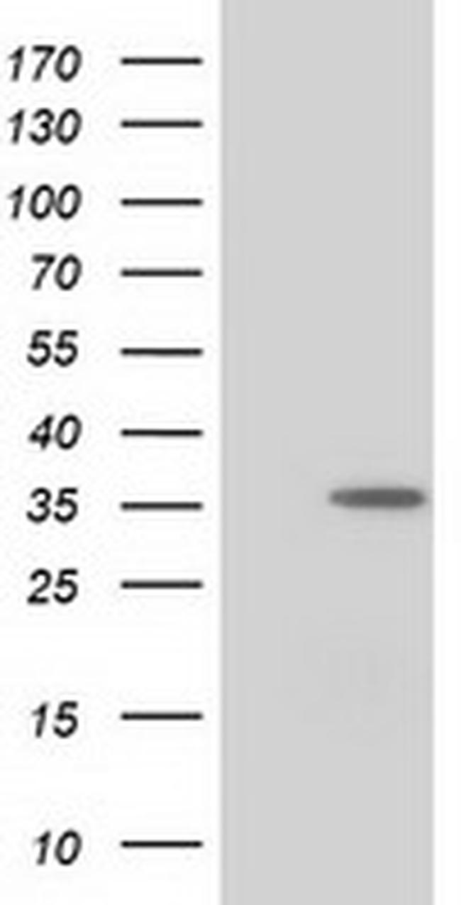 NUDT6 Antibody in Western Blot (WB)