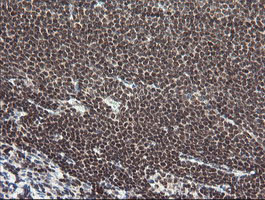 NUMB Antibody in Immunohistochemistry (Paraffin) (IHC (P))