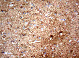NUMB Antibody in Immunohistochemistry (Paraffin) (IHC (P))