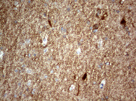 NUMB Antibody in Immunohistochemistry (Paraffin) (IHC (P))