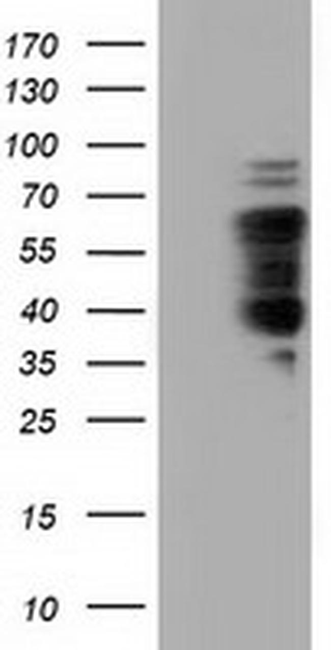 NUMB Antibody in Western Blot (WB)