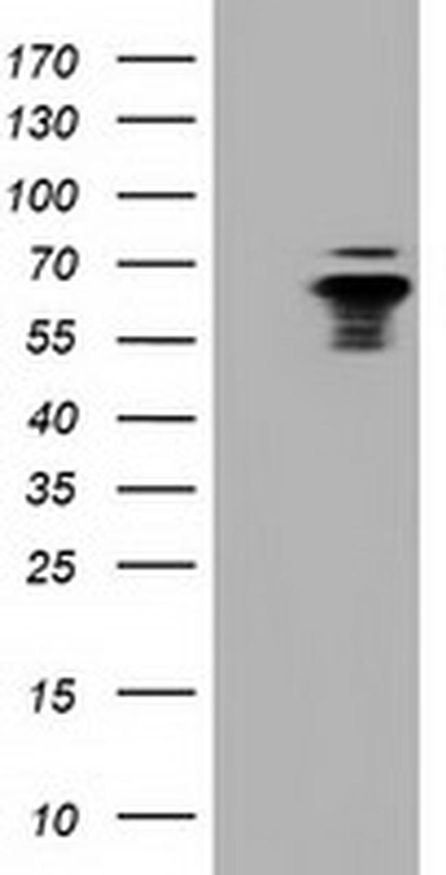 NUMB Antibody in Western Blot (WB)