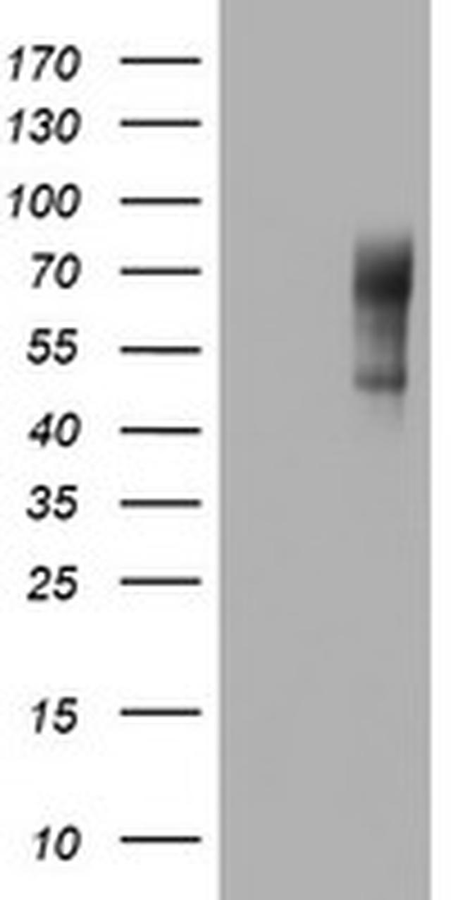 NUMB Antibody in Western Blot (WB)