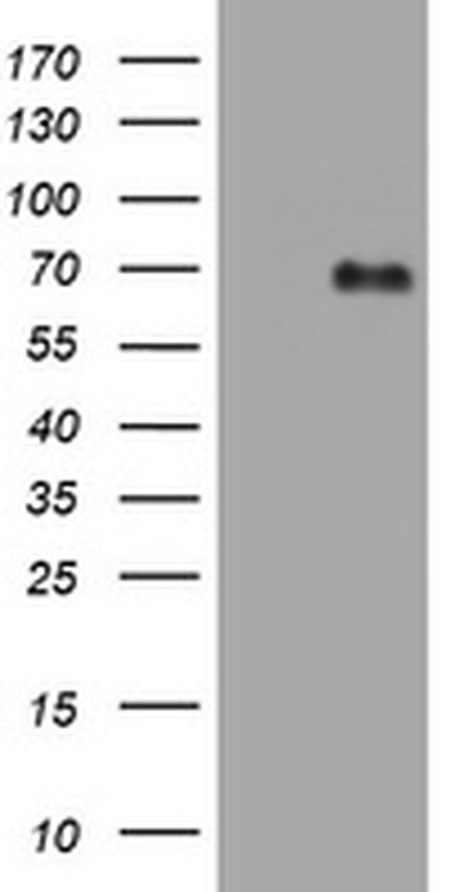 NUMB Antibody in Western Blot (WB)