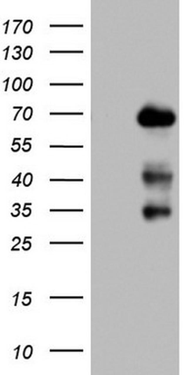 NUMB Antibody in Western Blot (WB)