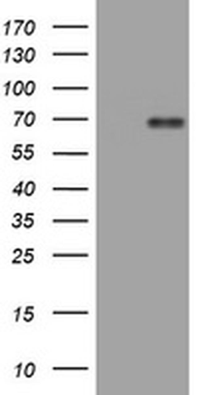NUMB Antibody in Western Blot (WB)