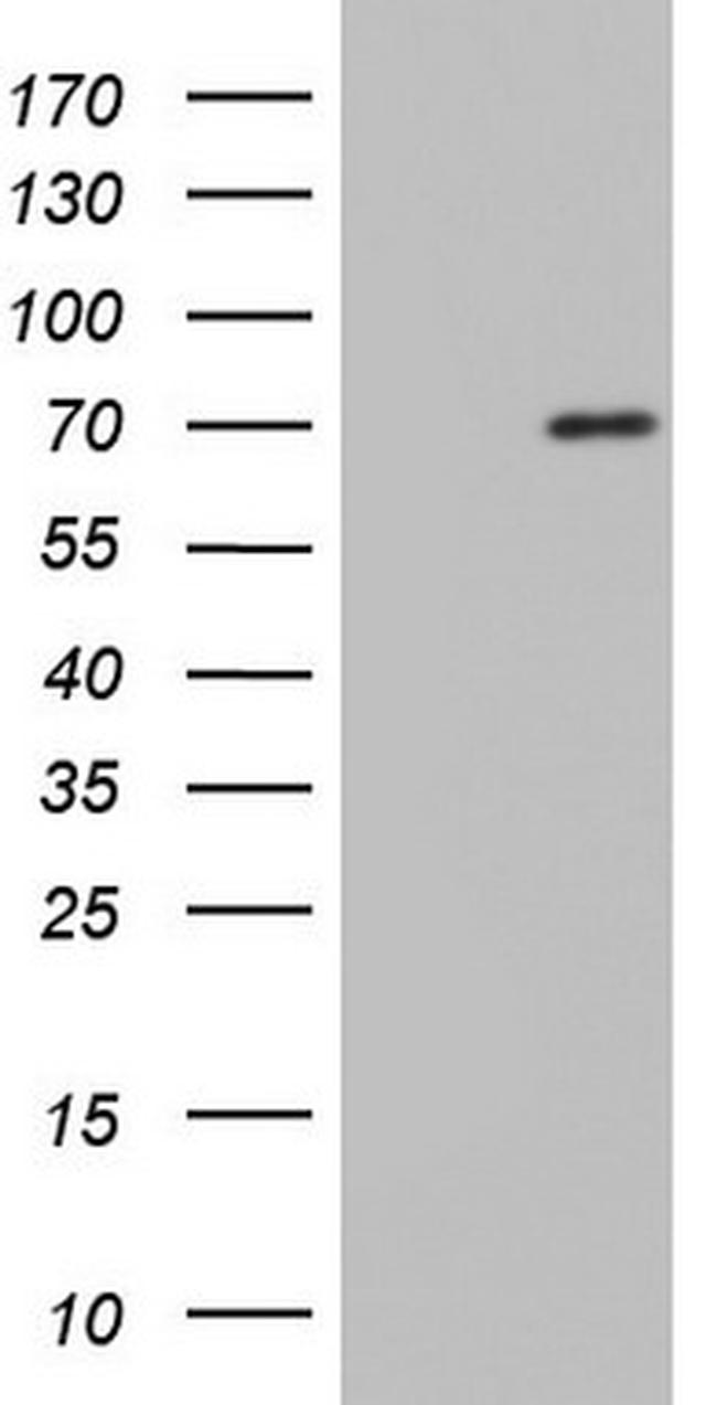 NUMB Antibody in Western Blot (WB)