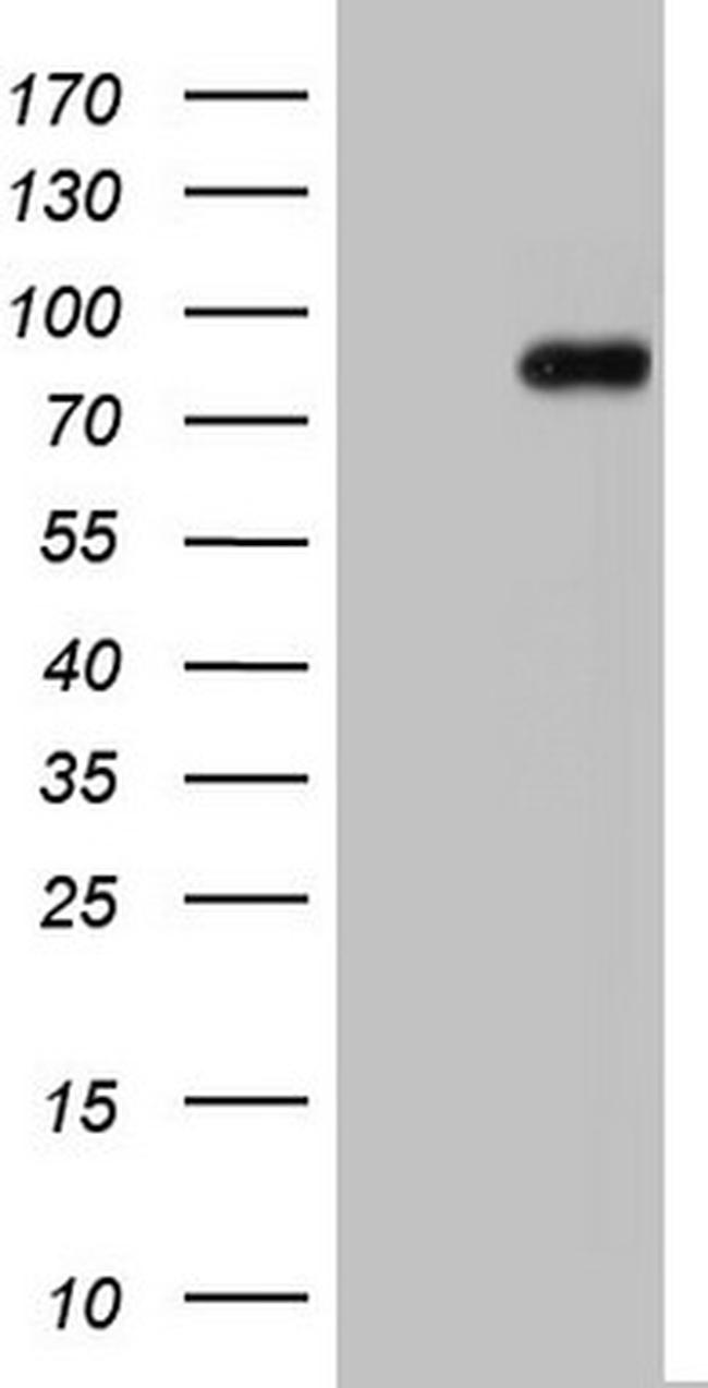 NUMB Antibody in Western Blot (WB)