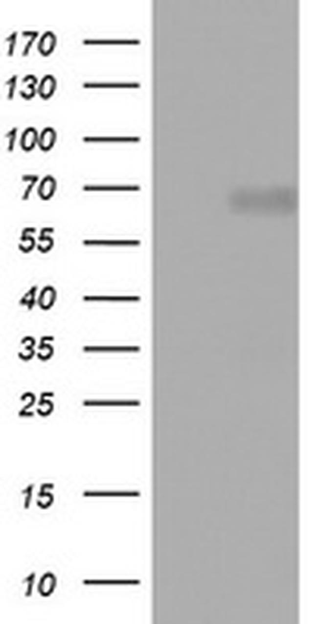 NUMB Antibody in Western Blot (WB)