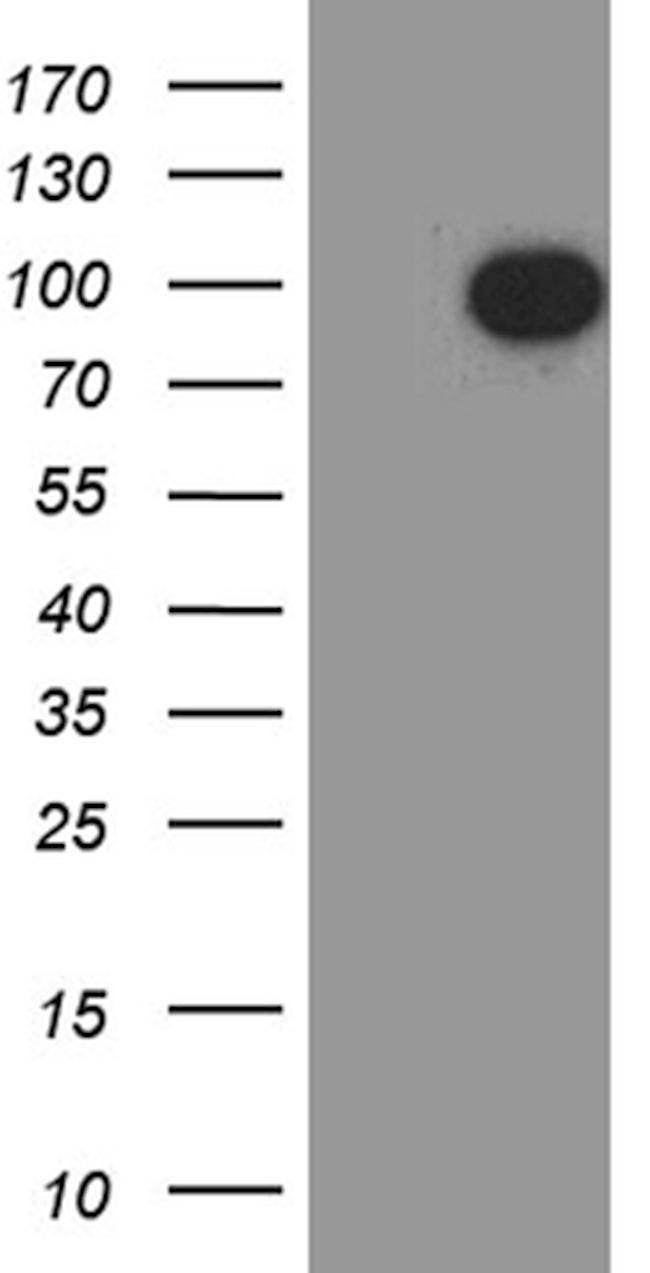 NUMBL Antibody in Western Blot (WB)