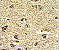 NUP155 Antibody in Immunohistochemistry (IHC)