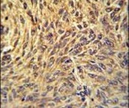 gp210 Antibody in Immunohistochemistry (IHC)