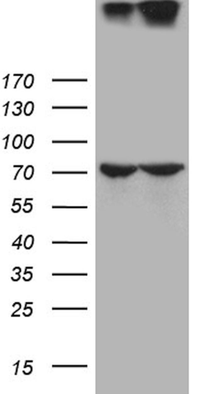 NUP210 Antibody in Western Blot (WB)