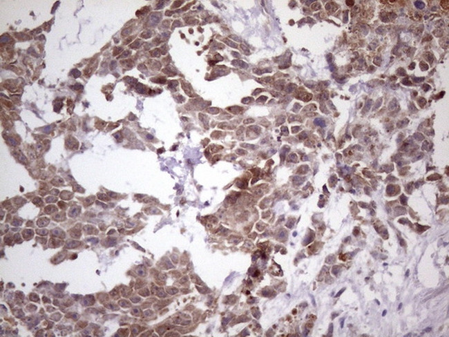 NUP43 Antibody in Immunohistochemistry (Paraffin) (IHC (P))