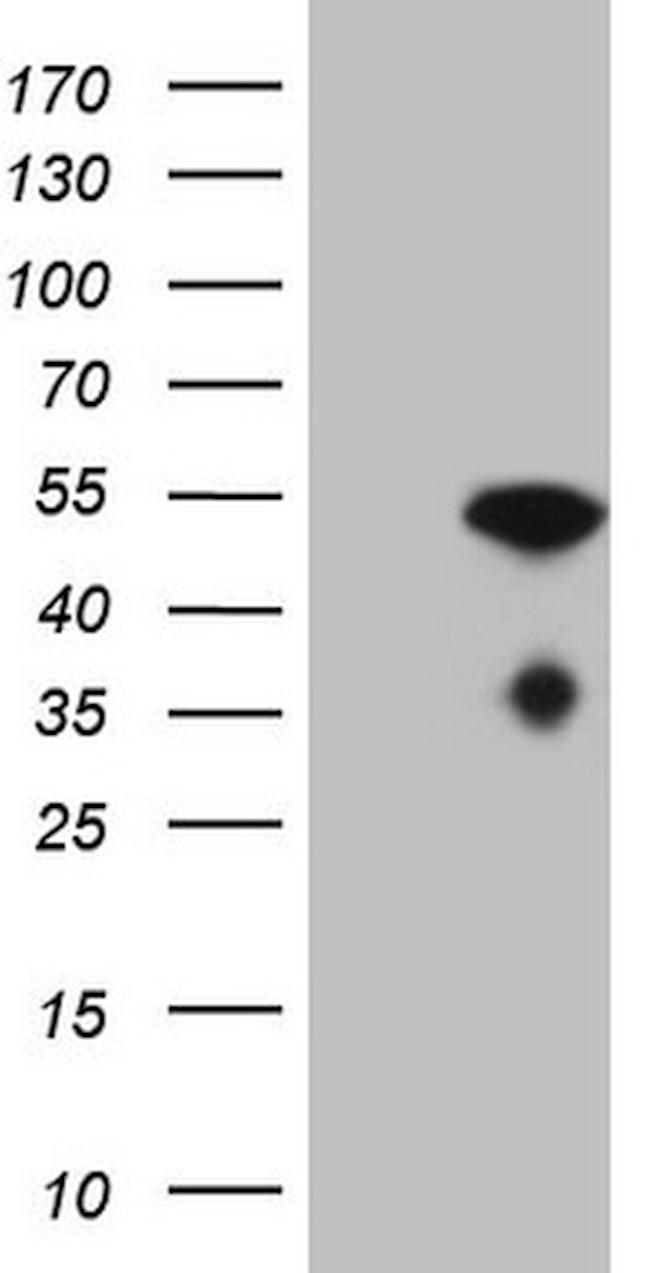 NUP43 Antibody in Western Blot (WB)