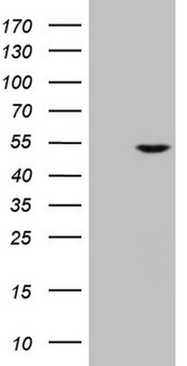 NUP43 Antibody in Western Blot (WB)