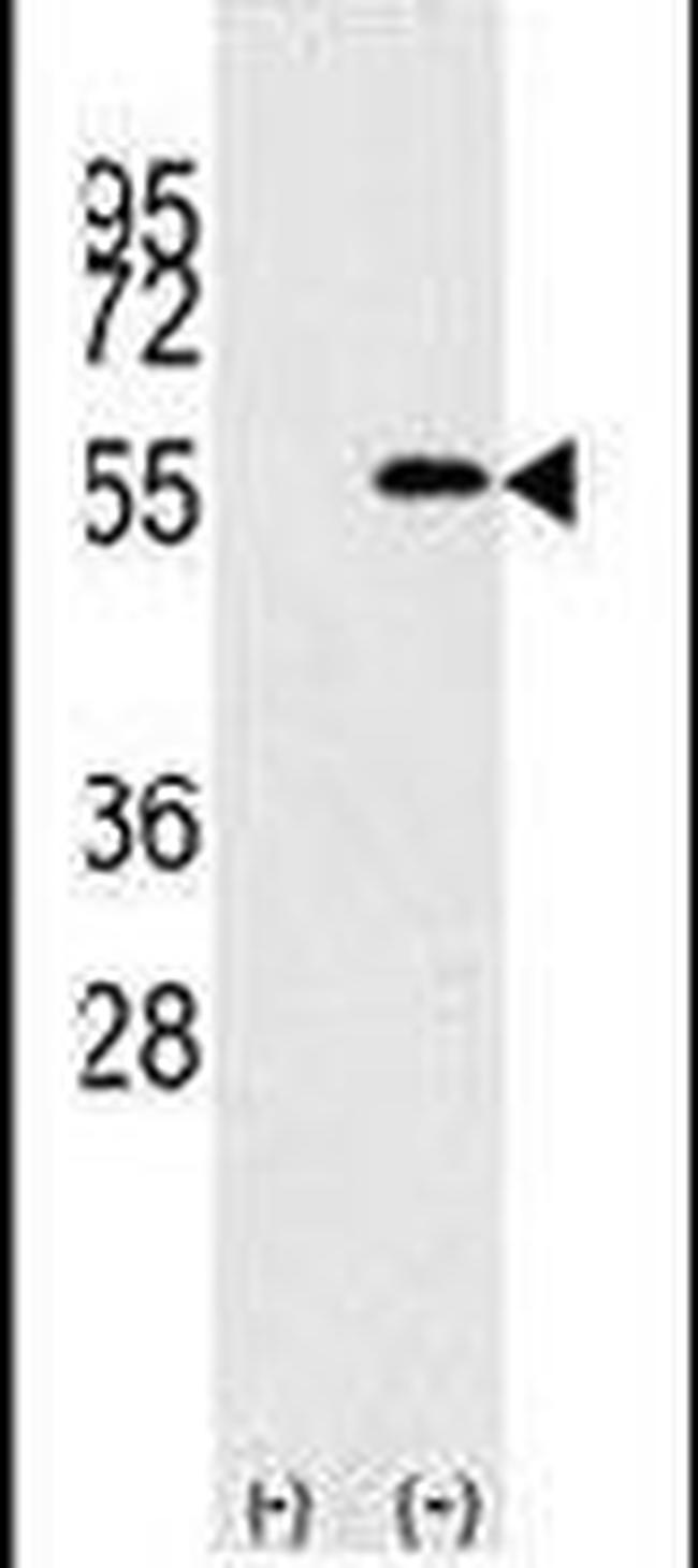 NUP50 Antibody in Western Blot (WB)
