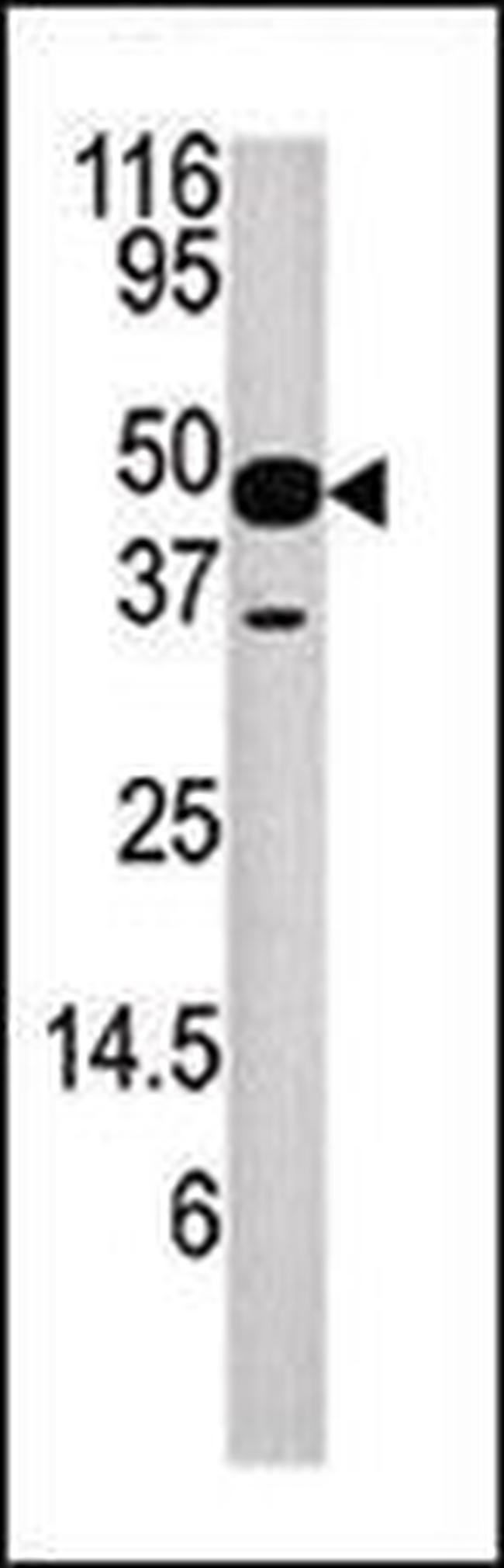 NUP54 Antibody in Western Blot (WB)