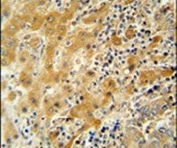 NUSAP1 Antibody in Immunohistochemistry (IHC)