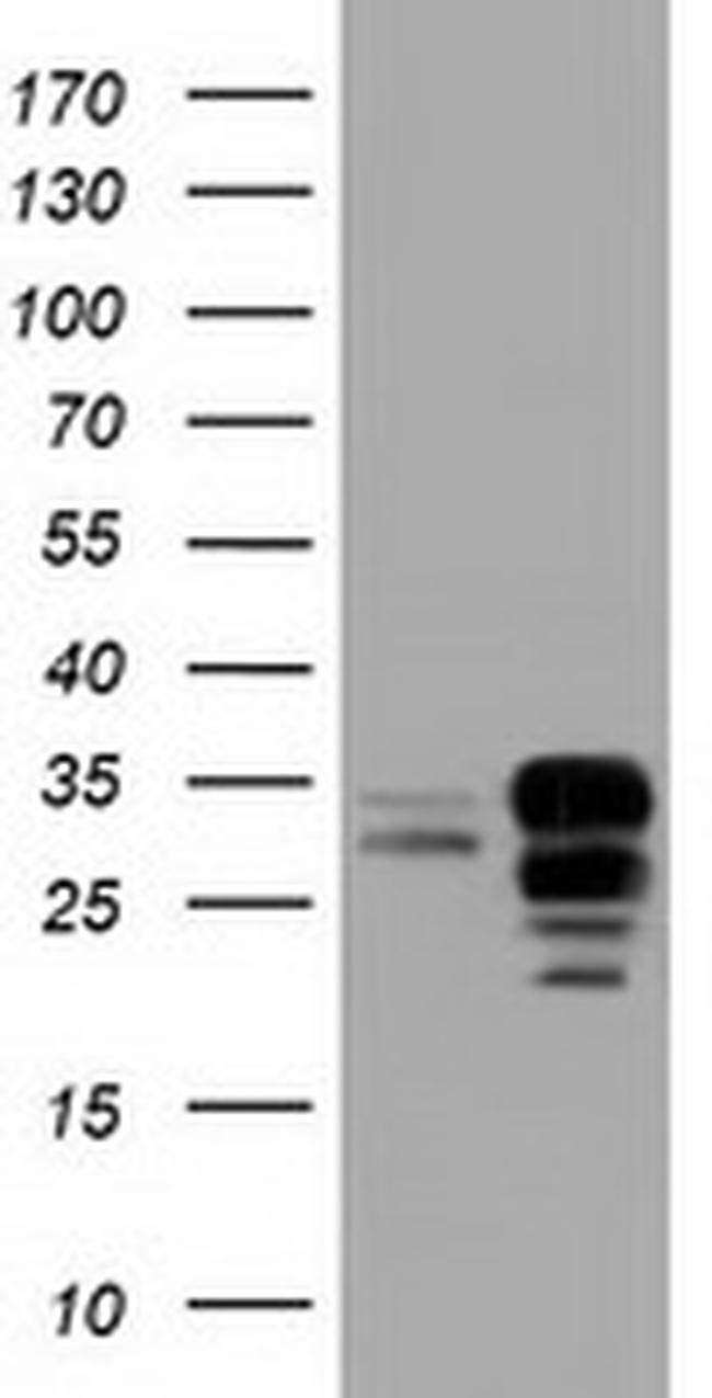 NXNL2 Antibody in Western Blot (WB)