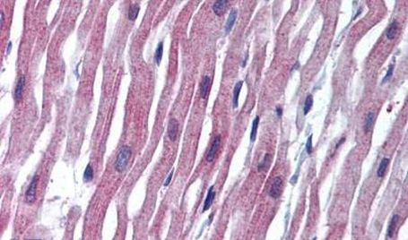 SCN5A Antibody in Immunohistochemistry (Paraffin) (IHC (P))