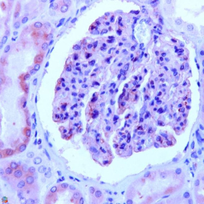 Nephrin Antibody in Immunohistochemistry (IHC)