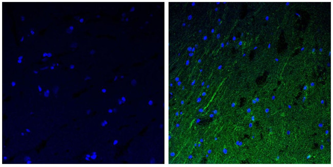 NEFM Antibody in Immunohistochemistry (Paraffin) (IHC (P))
