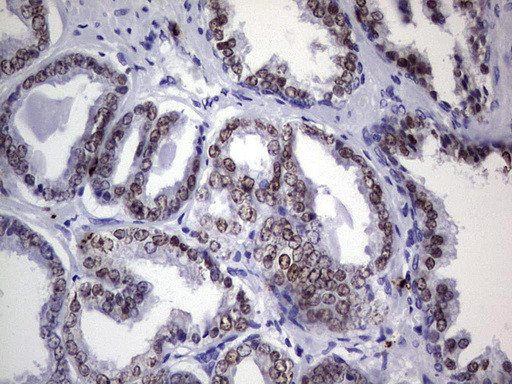 NKX3.1 Antibody in Immunohistochemistry (Paraffin) (IHC (P))