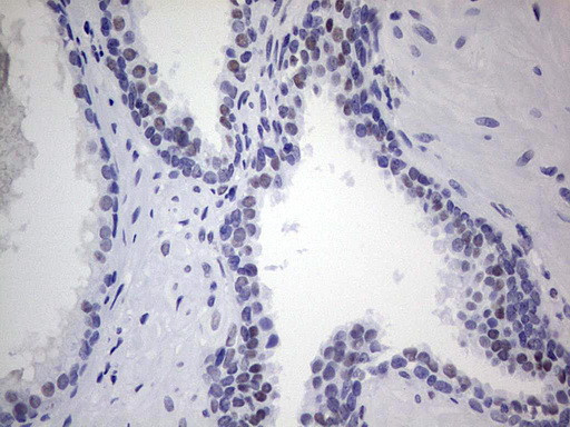 NKX3.1 Antibody in Immunohistochemistry (Paraffin) (IHC (P))