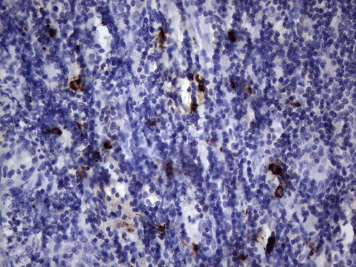 NKX3.1 Antibody in Immunohistochemistry (Paraffin) (IHC (P))