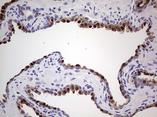 NKX3.1 Antibody in Immunohistochemistry (Paraffin) (IHC (P))