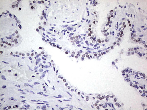 NKX3.1 Antibody in Immunohistochemistry (Paraffin) (IHC (P))